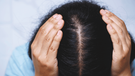 NMN and its Role in Combating Hair Loss